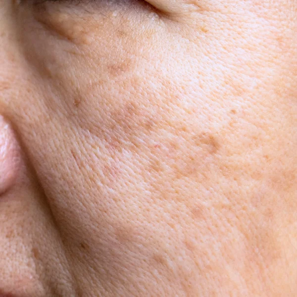 Peptide Therapy For Anti-aging