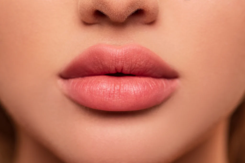 A close-up of full, plump lips enhanced with Juvederm lip filler.