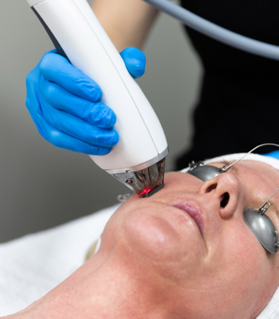 Laser Treatments Latham | The Hebe Medical Spa Medical Spa