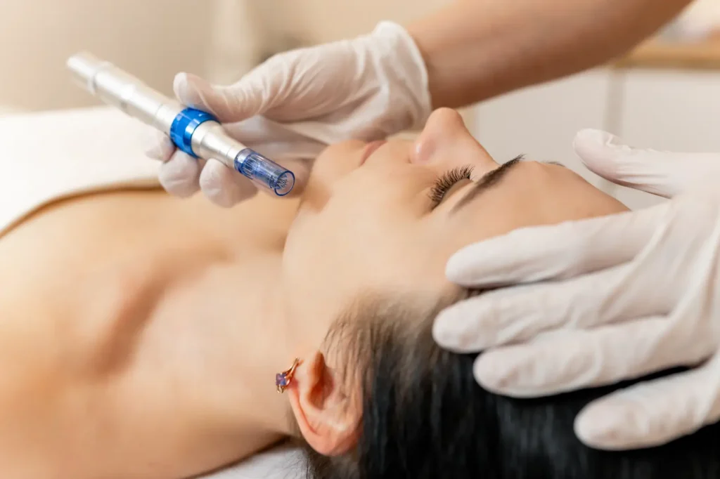 Practitioner uses a microneedling pen on a person's jawline while supporting the head with gloved hands.